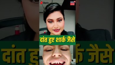 Got teeth like a shark. Turkey Model | Turkey News | #Shorts Got teeth like a shark. Turkey Model | Turkey News | #Shorts