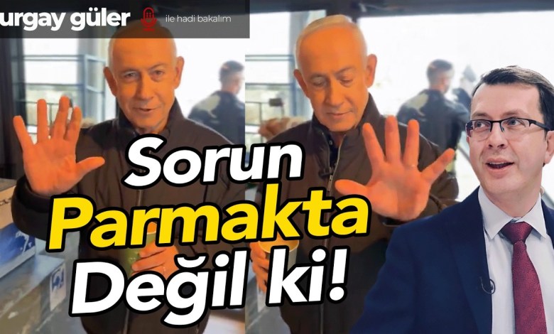 The problem is not in the fingers! | Turgay Güler Comments The problem is not in the fingers! | Turgay Güler Comments