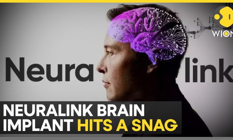 Elon Musk’s Neuralink brain implant malfunctioned weeks post-operation | World News | WION Elon Musk’s Neuralink brain implant malfunctioned weeks post-operation | World News | WION