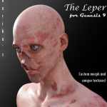 Baldwin the Leper for G9 Baldwin the Leper for G9