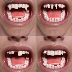 Teeth Master Control for Genesis 8 Male Teeth Master Control for Genesis 8 Male