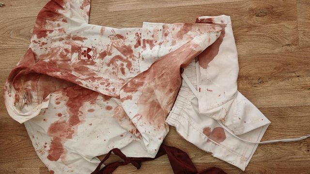 Luann Combrinck’s blood-soaked school uniform, a grim testament to the brutal home invasion in Wonderboom that left the white teen fighting for his life. Luann Combrinck’s blood-soaked school uniform, a grim testament to the brutal home invasion in Wonderboom that left the white teen fighting for his life.