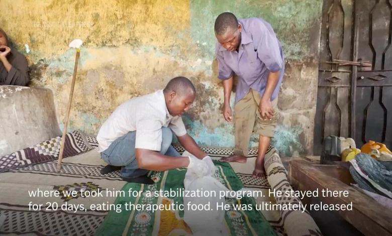 U.S. aid keeps many hungry Somali children alive. Money is disappearing now U.S. aid keeps many hungry Somali children alive. Money is disappearing now