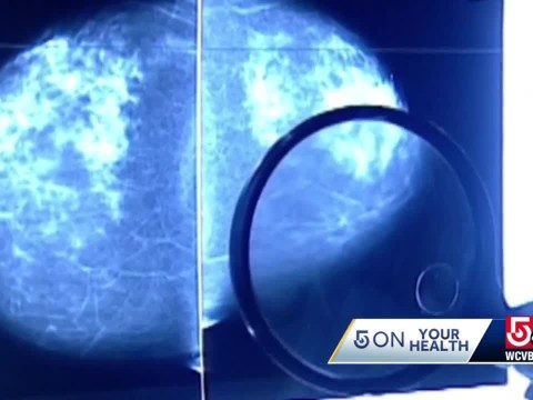 New breast cancer screening test focuses on Black community New breast cancer screening test focuses on Black community