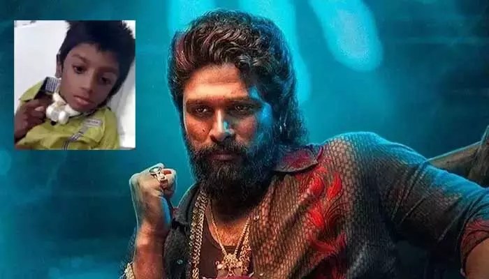 SriTeja Health Update : అల్లు అర్జున్ FD చేశారు : శ్రీతేజ తండ్రి SriTeja Health Update : అల్లు అర్జున్ FD చేశారు : శ్రీతేజ తండ్రి