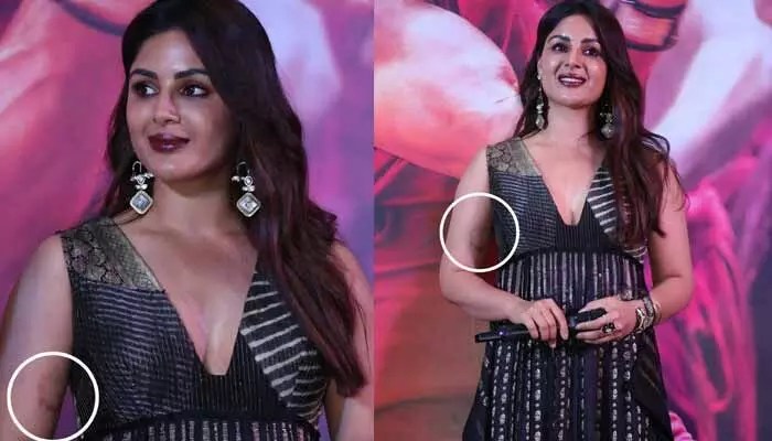 Samyuktha Menon's Hand Injury: The Real Reason Behind 'Swayambhu' Star's Wound Samyuktha Menon's Hand Injury: The Real Reason Behind 'Swayambhu' Star's Wound