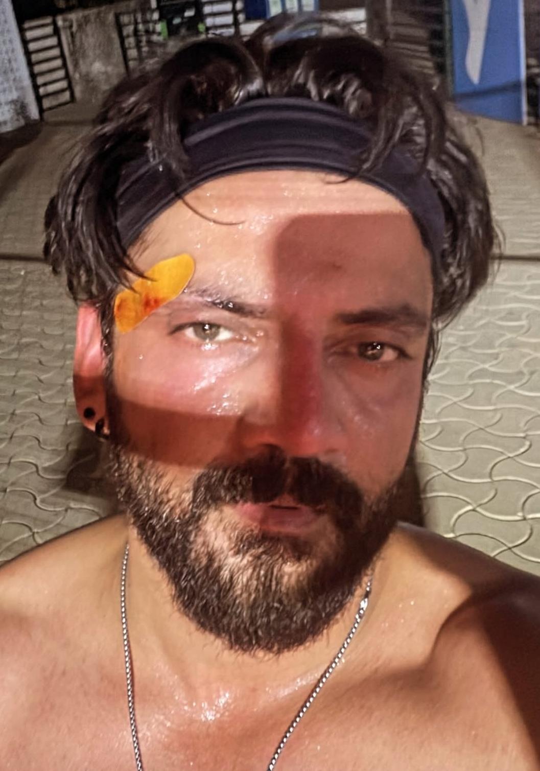 Zaheer Iqbal shows padel injury with bandage on forehead Zaheer Iqbal shows padel injury with bandage on forehead