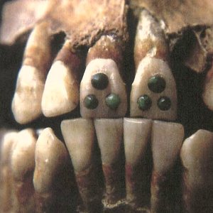 Ancient Maya Tooth Bling Was Also Good for Oral Hygiene! Ancient Maya Tooth Bling Was Also Good for Oral Hygiene!