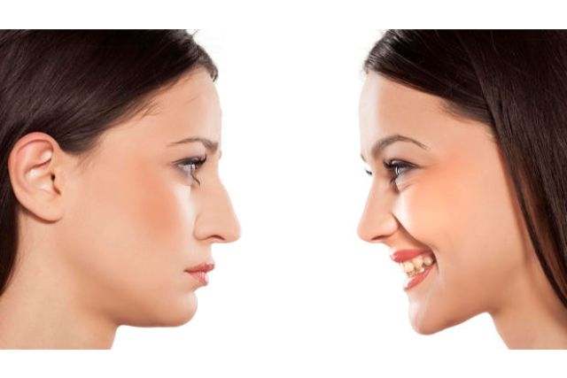 facial reconstruction Boston facial reconstruction Boston