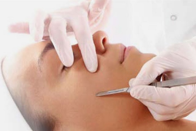 Dermaplaning Dermaplaning