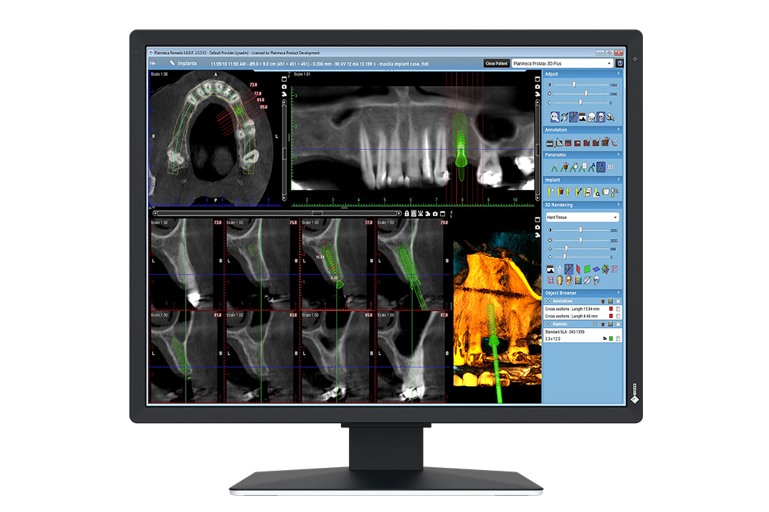 21" EIZO RadiForce MX217-HB