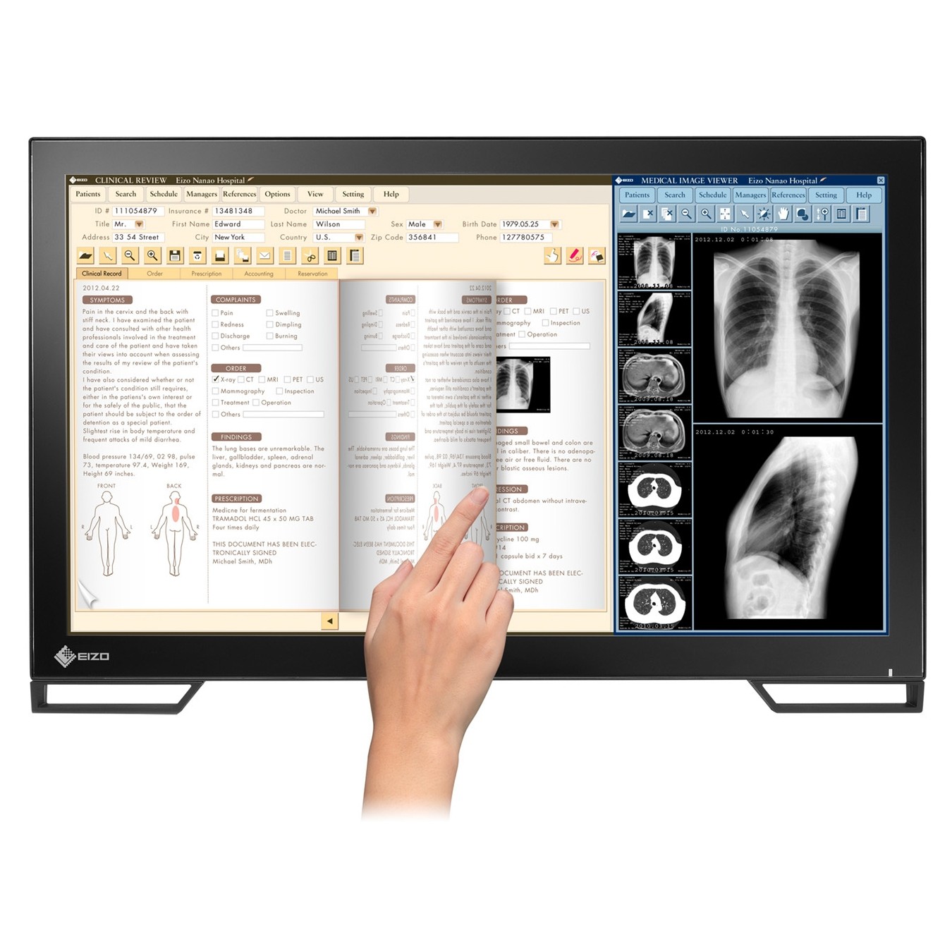 23" EIZO RadiForce MS236WT