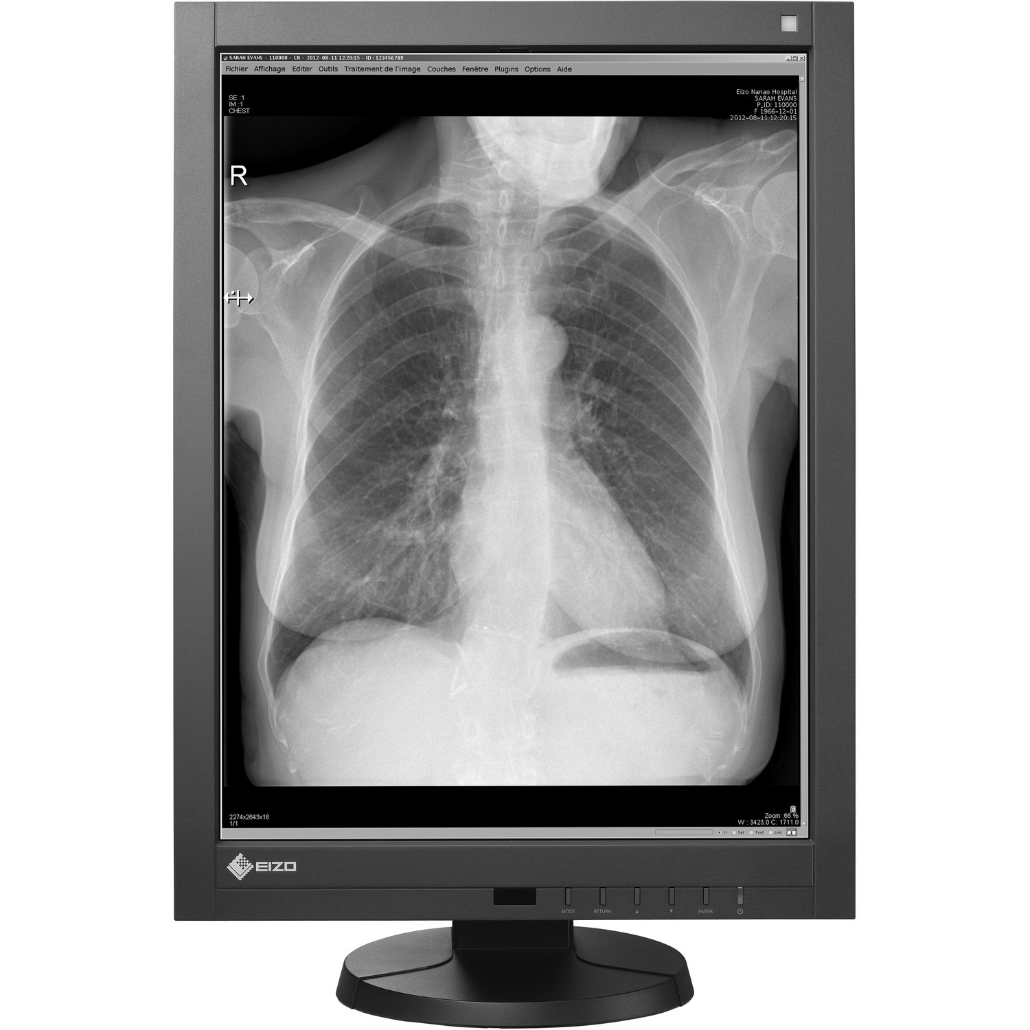 21.3" EIZO RadiForce GX340