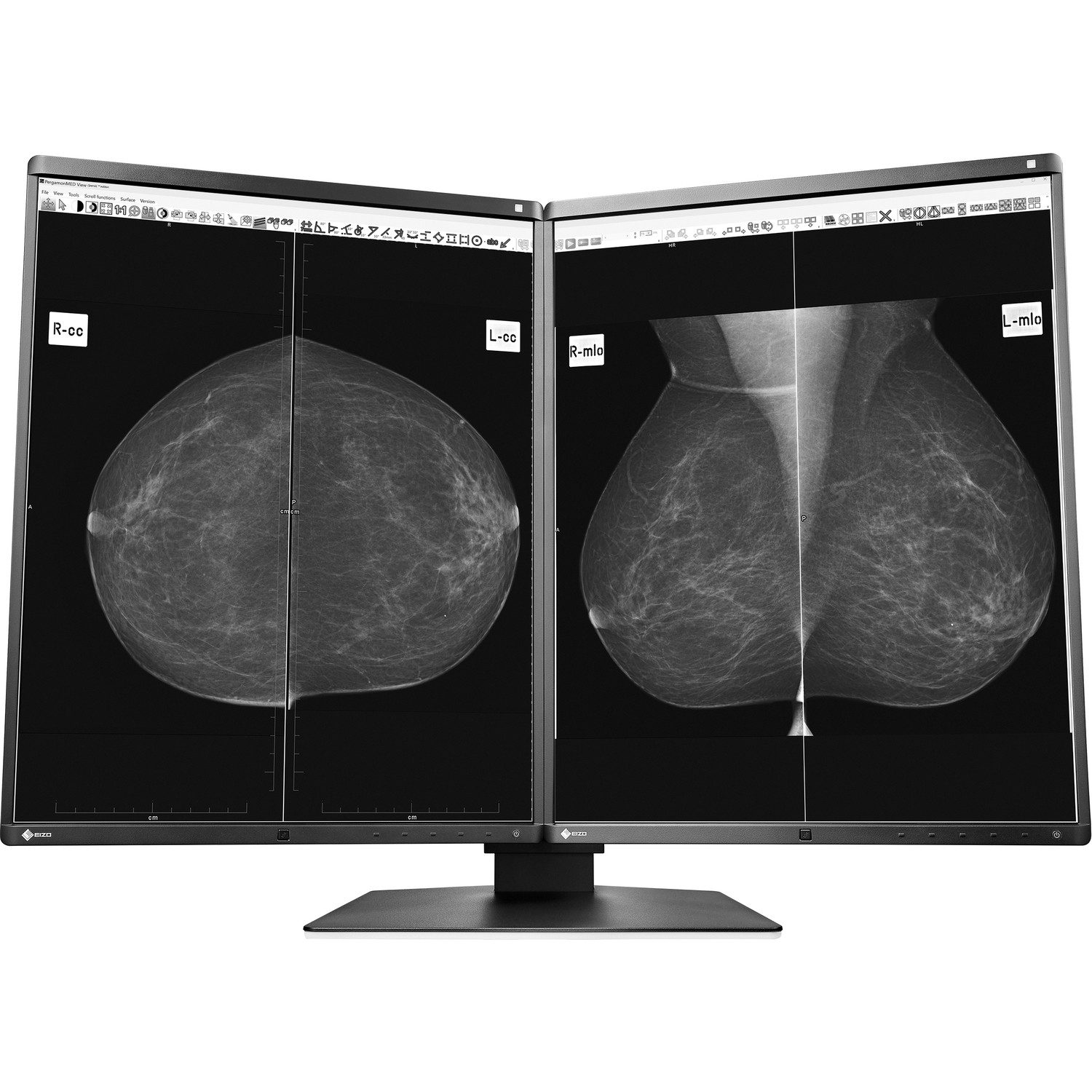 21.3" EIZO RadiForce GX560-MD