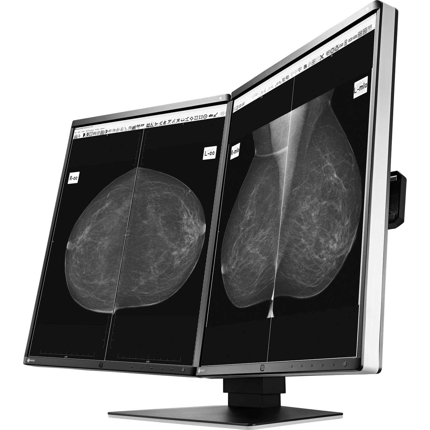 21.3" EIZO RadiForce GX560-MD