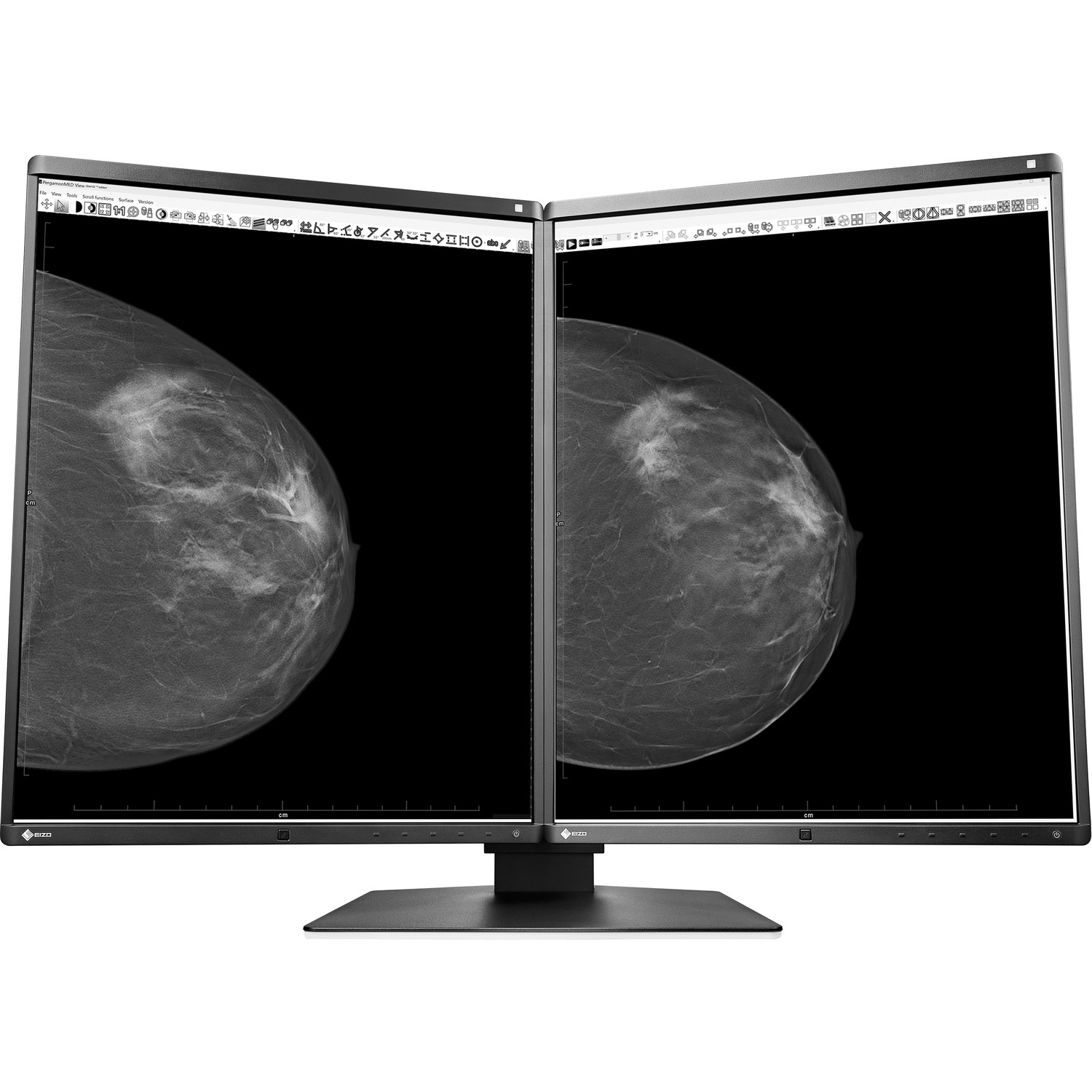 21.3" EIZO RadiForce GX560-MD