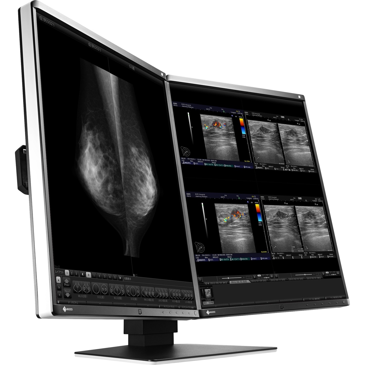 21.3" EIZO RadiForce RX560-MD