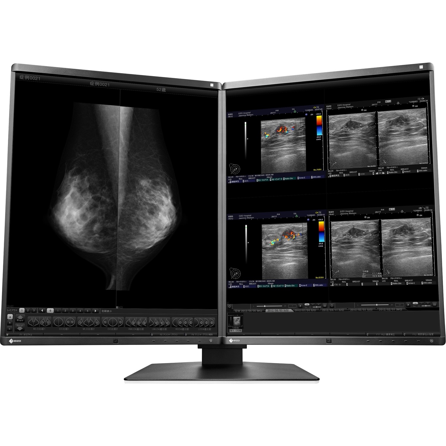 21.3" EIZO RadiForce RX560-MD