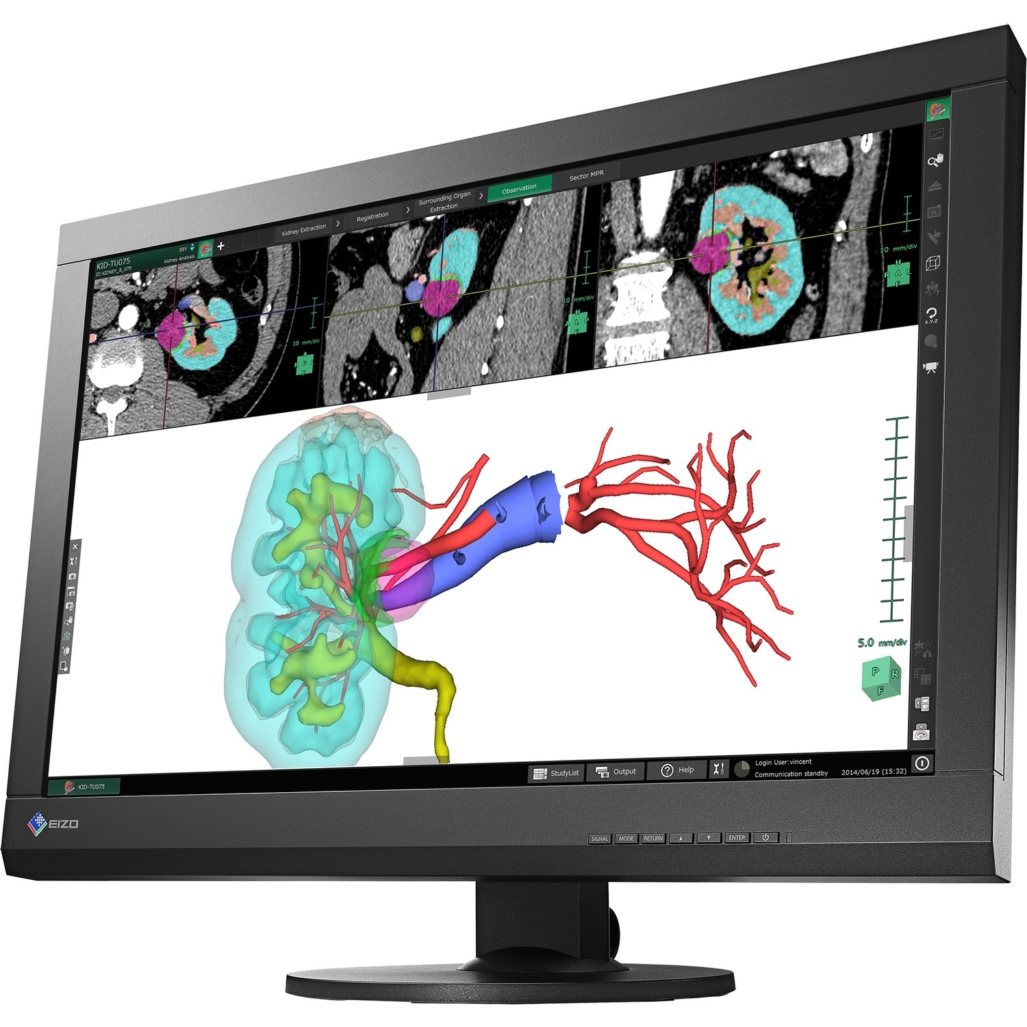 24.1" EIZO Radiforce MX242W