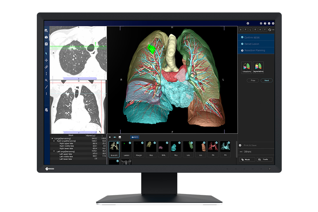 24.1" EIZO Radiforce MX243W