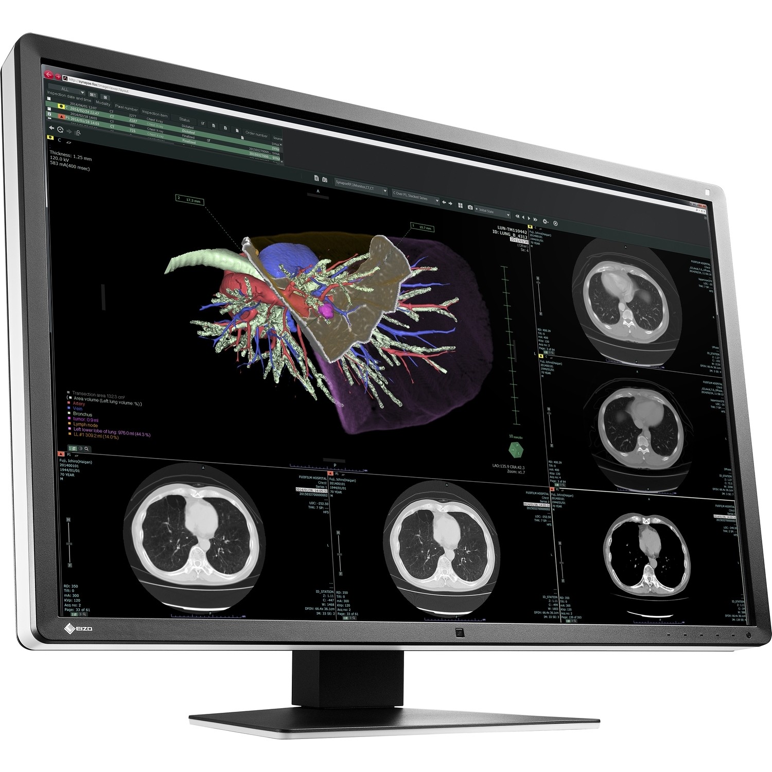 30" EIZO RadiForce RX660