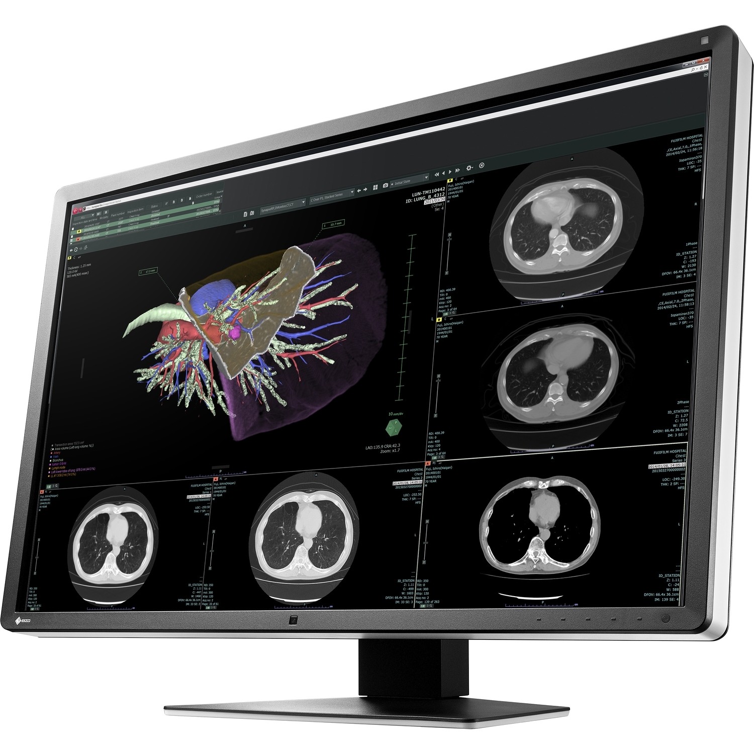 30" EIZO RadiForce RX660