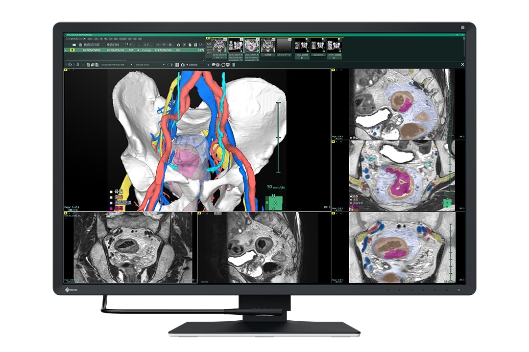 30" EIZO RadiForce RX670