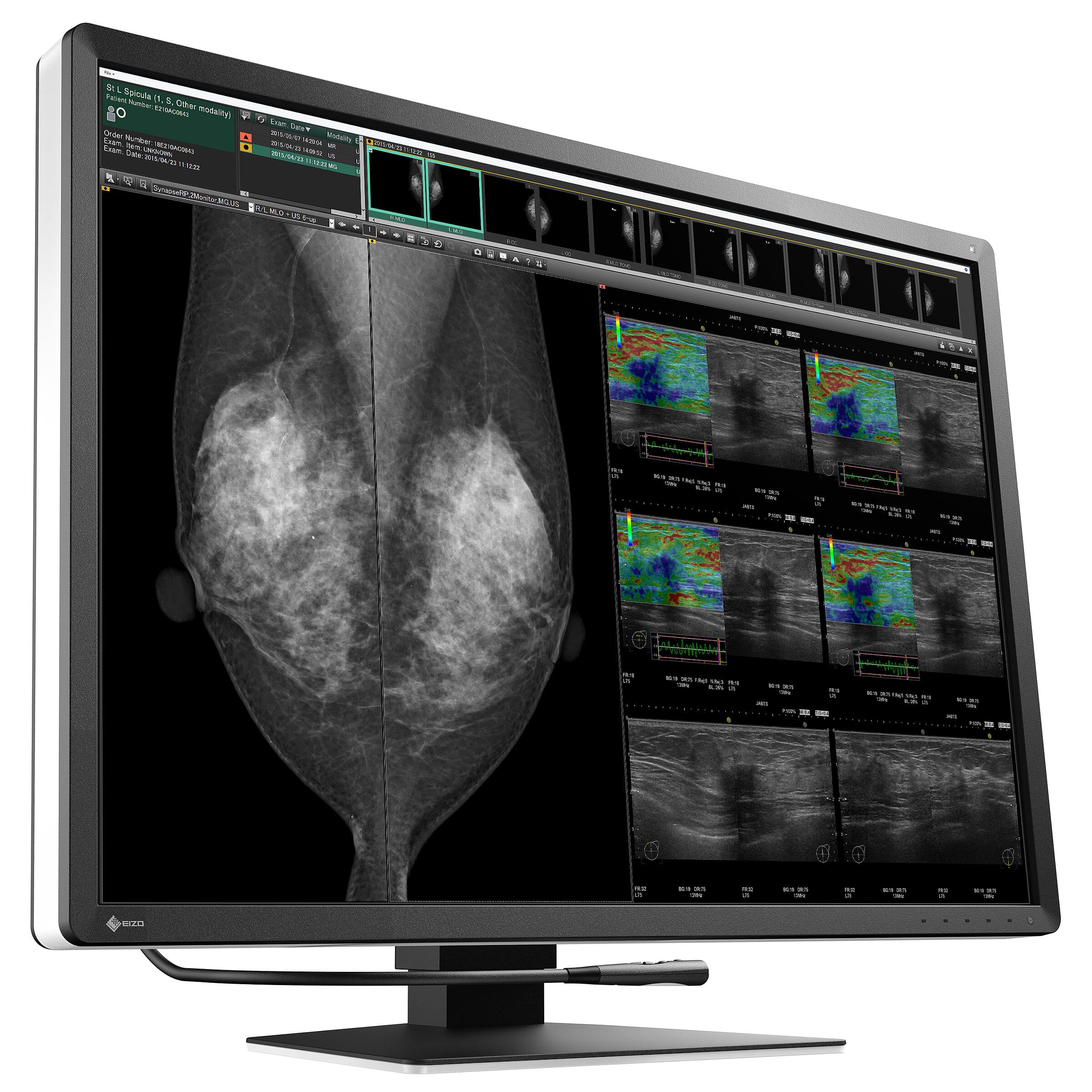 31" EIZO RadiForce RX1270