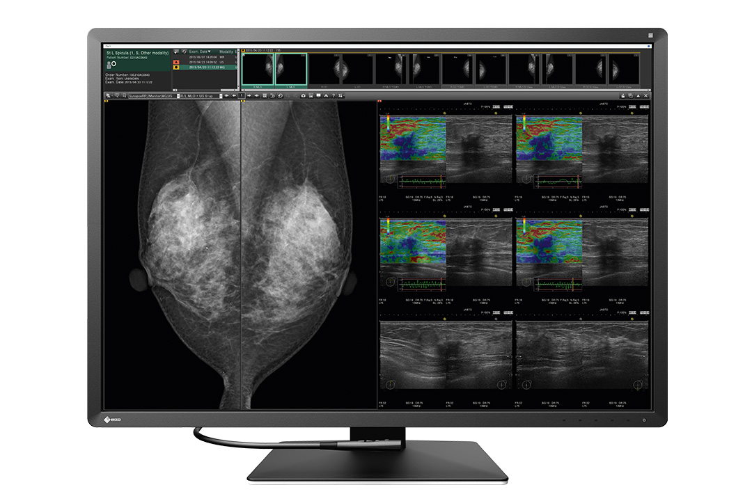 31" EIZO RadiForce RX1270