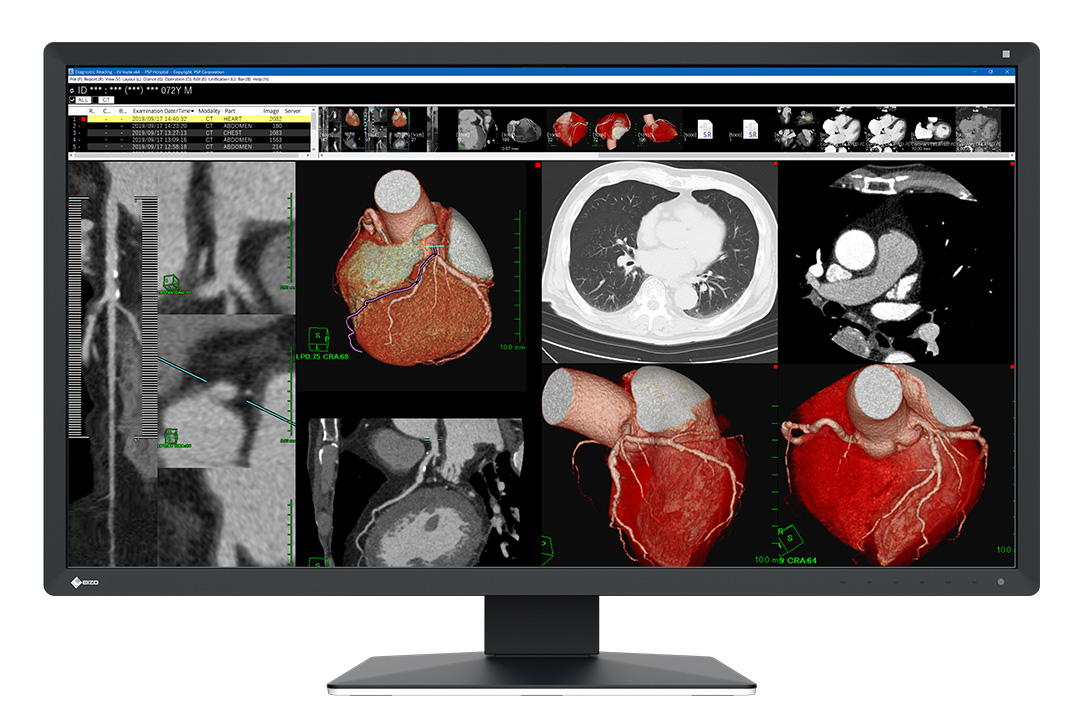 31" EIZO RadiForce MX317W