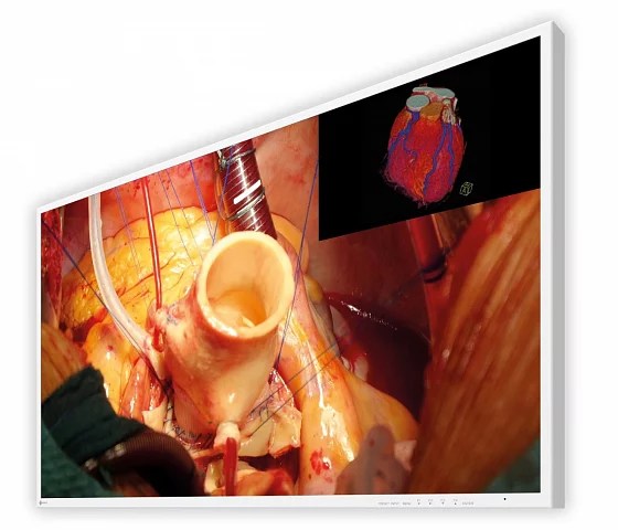 43" EIZO CuratOR EX4342