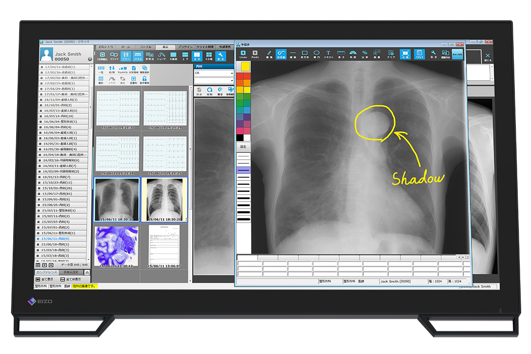 23" EIZO RadiForce MS236WT-A