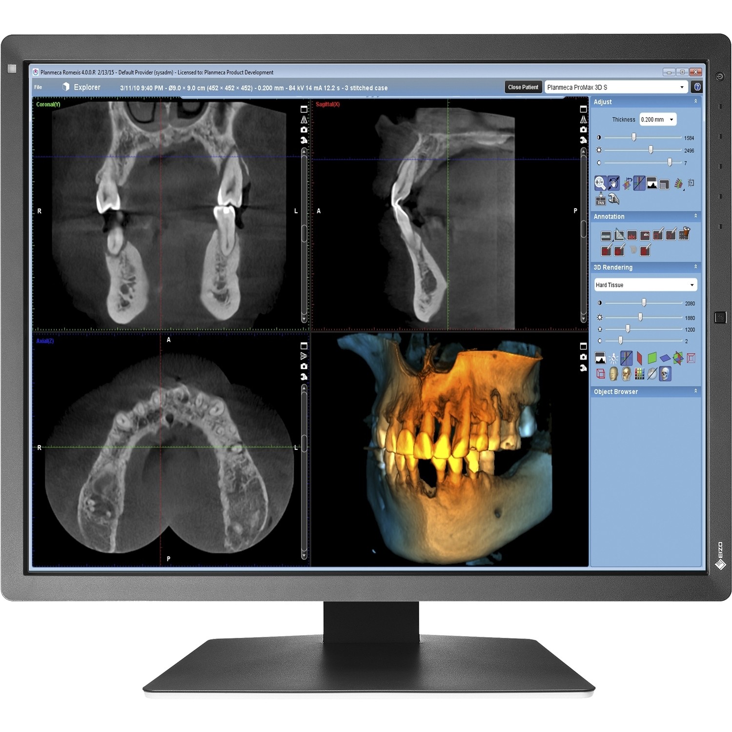21.3" EIZO RadiForce RX250
