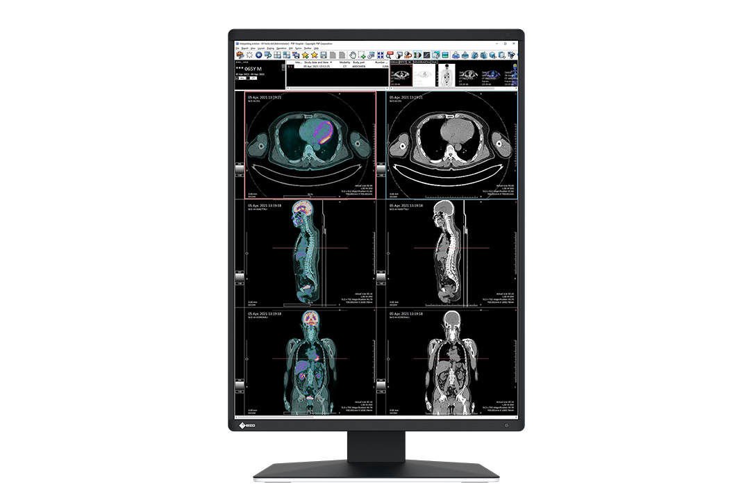 21.3" EIZO RadiForce RX370