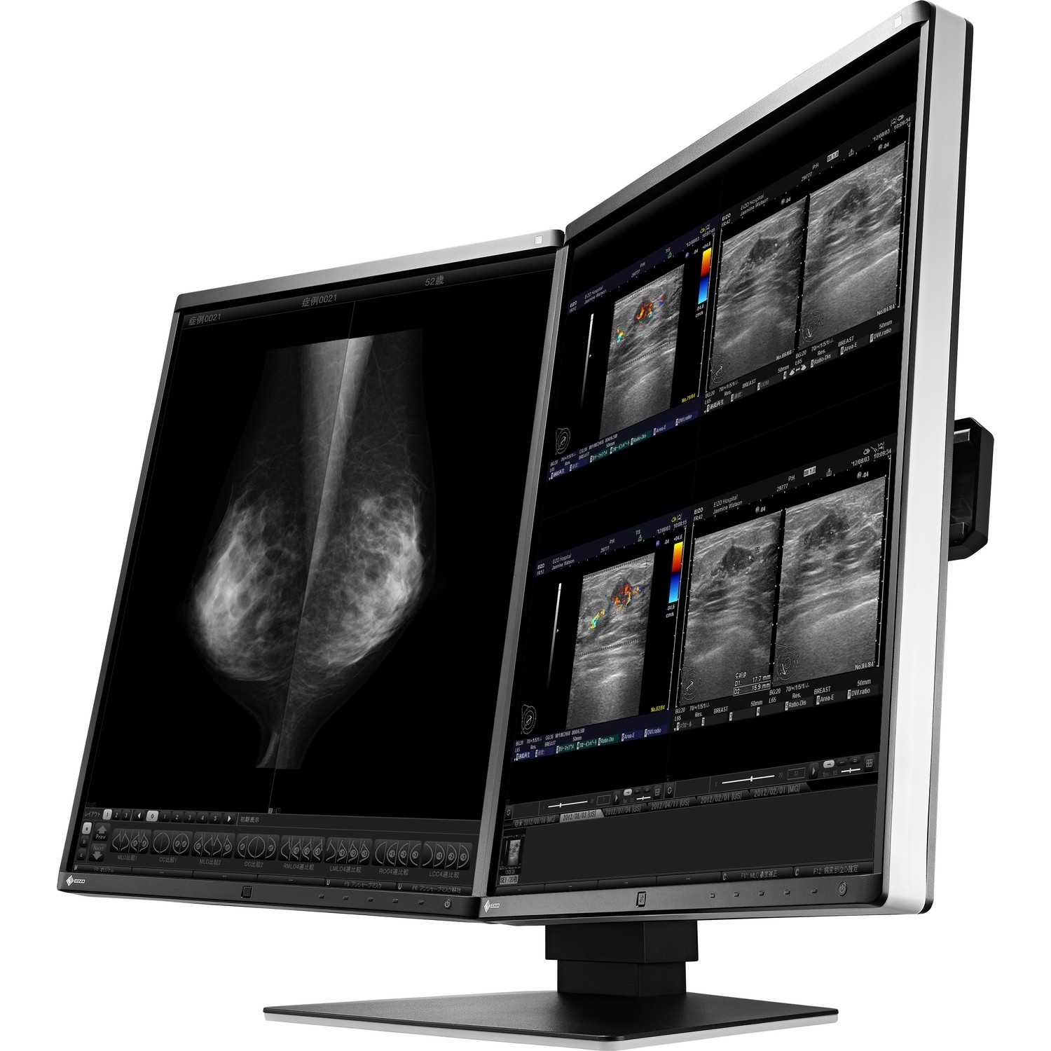 21.3" EIZO RadiForce RX560-MD