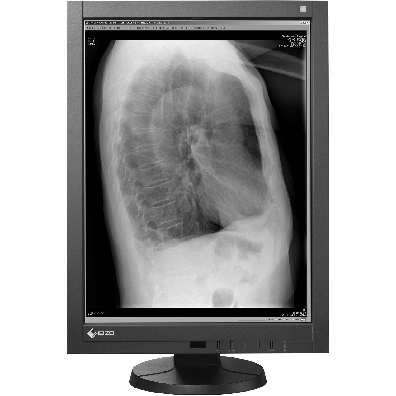 21.3" EIZO RadiForce GX240