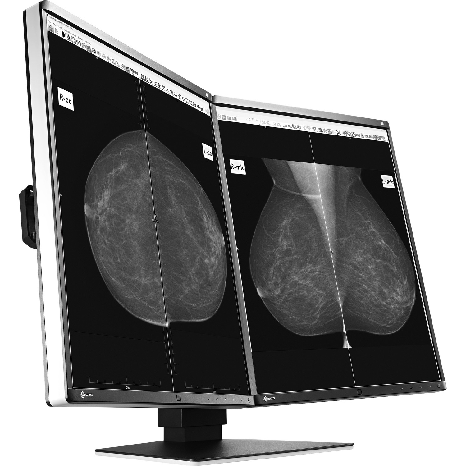 21.3" EIZO RadiForce GX560-MD