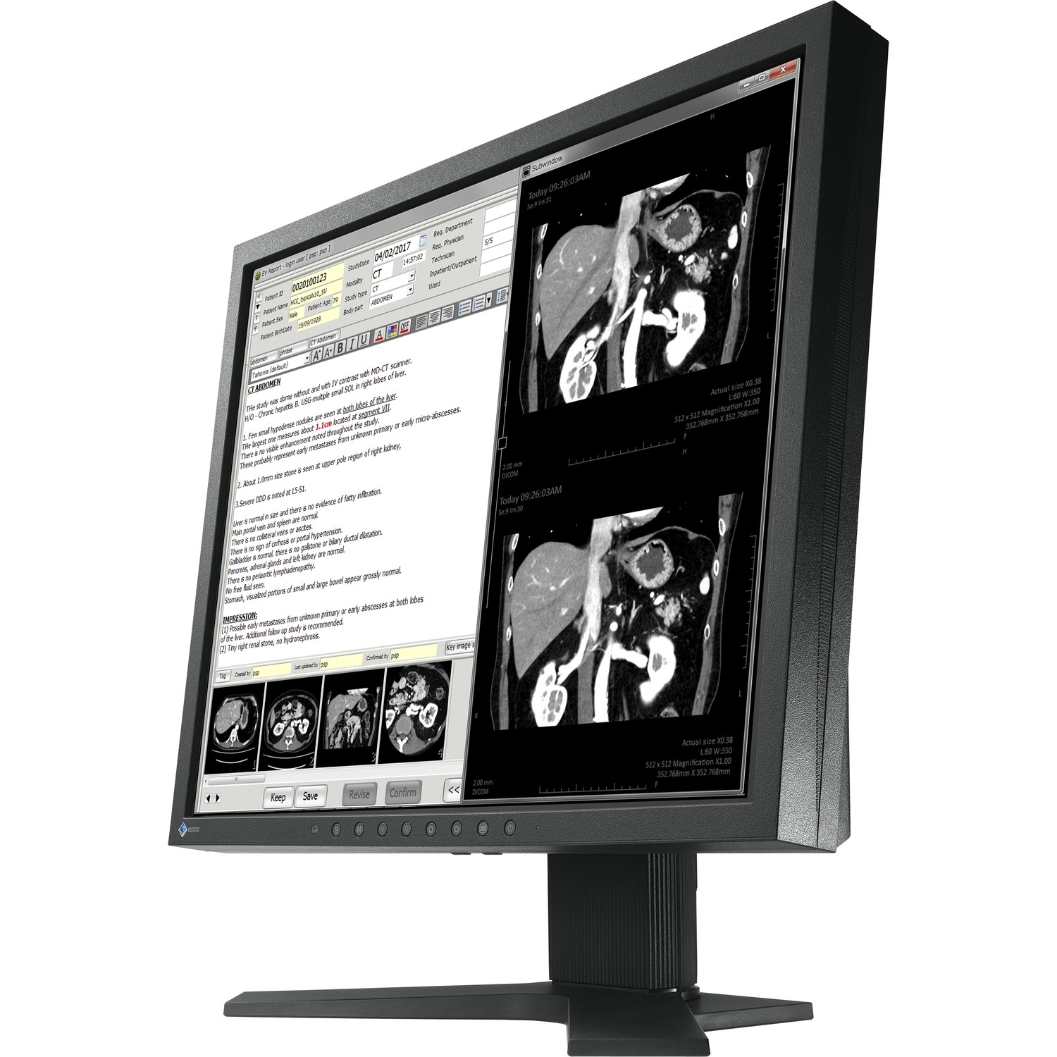 19" EIZO RadiForce MX194