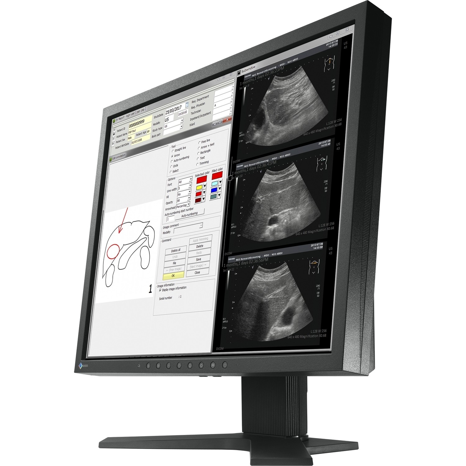 19" EIZO RadiForce MX194