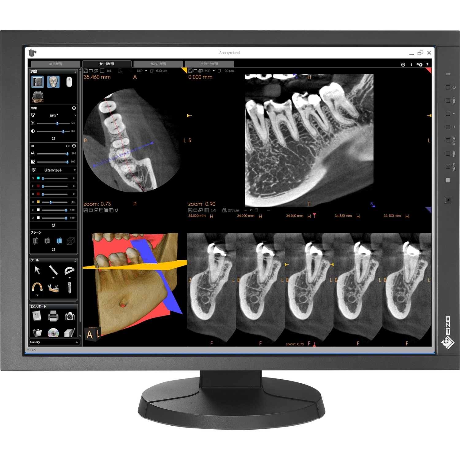 21" EIZO RadiForce MX215