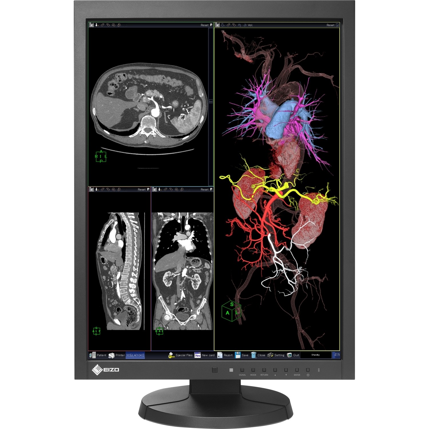 21" EIZO RadiForce MX215