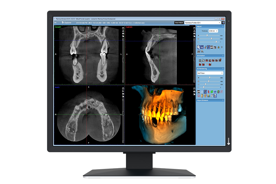 21" EIZO RadiForce MX217-SB