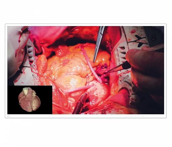 49" EIZO CuratOR EX4942