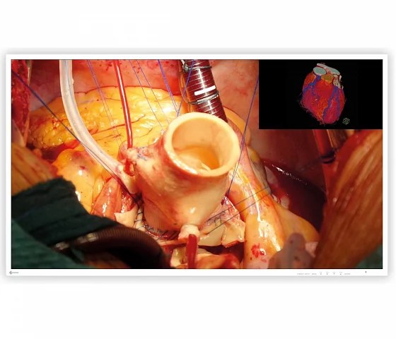 43" EIZO CuratOR EX4342