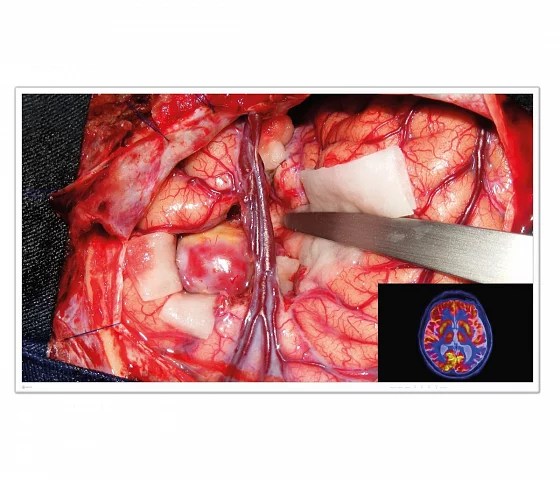 55" EIZO CuratOR EX5542