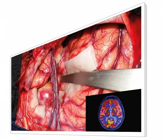 55" EIZO CuratOR EX5542