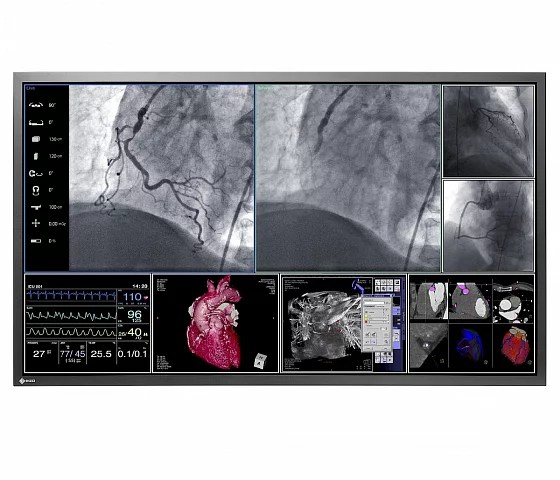 58" EIZO RadiForce LS580W