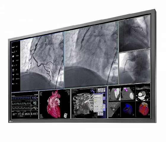 58" EIZO RadiForce LS580W