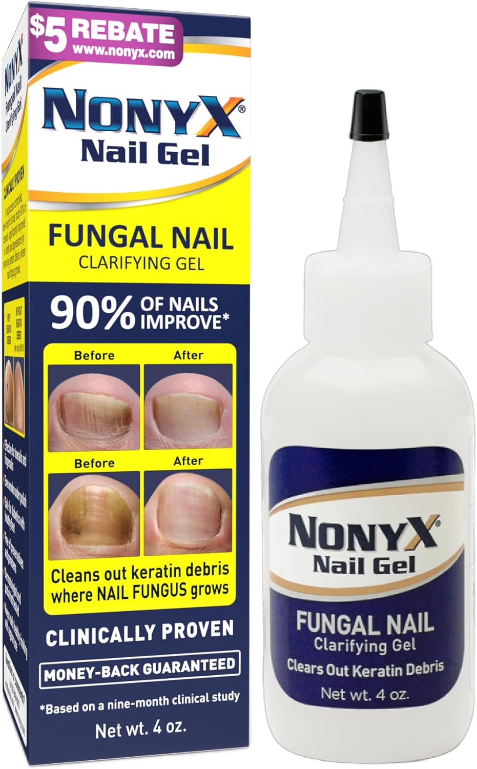 Nail Clarifying Gel | For Clear, Healthy-Looking Nails | Improves the Appearance of Discolored, Damaged, Thick or Brittle Toenails and Fingernails, 4 oz Nail Clarifying Gel | For Clear, Healthy-Looking Nails | Improves the Appearance of Discolored, Damaged, Thick or Brittle Toenails and Fingernails, 4 oz