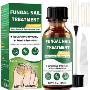 Toenail Fungus Treatment,Foot Fungus Treatment Extra Strength,Fungus Nail Treatment,Nail Fungus Treatment For Toenail, Toe Nail Fungus Treatments For Fungi Nail yellow toenail treatment